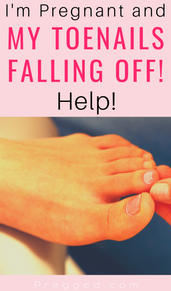 toenails-falling-off-pregnancy-a-detailed-guide-pregged