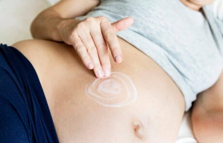 Top 5 Stretch Mark Creams & Oils Compared