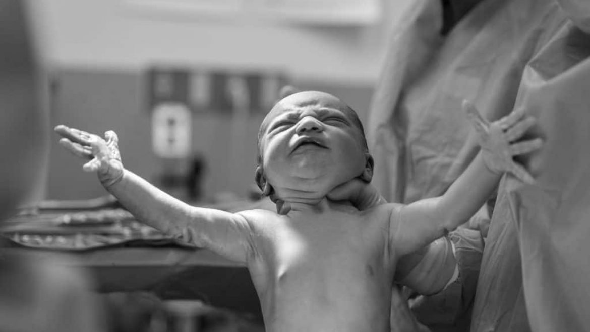 5 Benefits of Delayed Cord Clamping (DCC)
