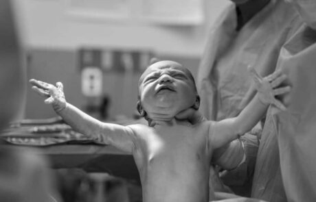 5 Benefits of Delayed Cord Clamping (DCC)