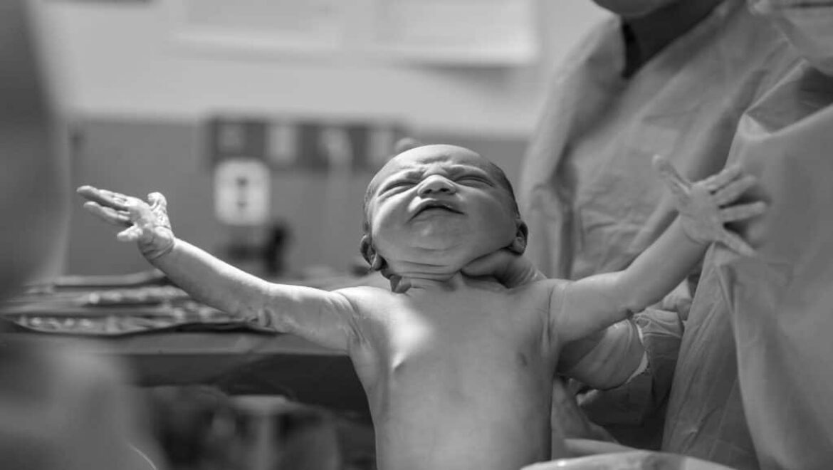 5 Benefits of Delayed Cord Clamping (DCC)