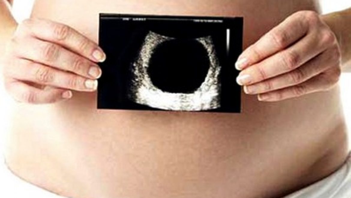 Blighted Ovum – It’s a Miscarriage NOT a Phantom Pregnancy