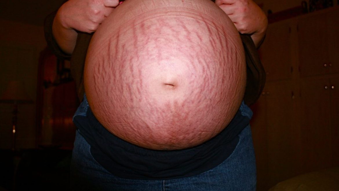 Common Third Trimester Symptoms *And* What to do About Them