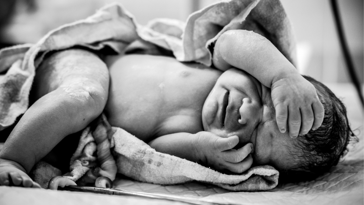 Is it Dangerous if Baby Has the Umbilical Cord Around their Neck?